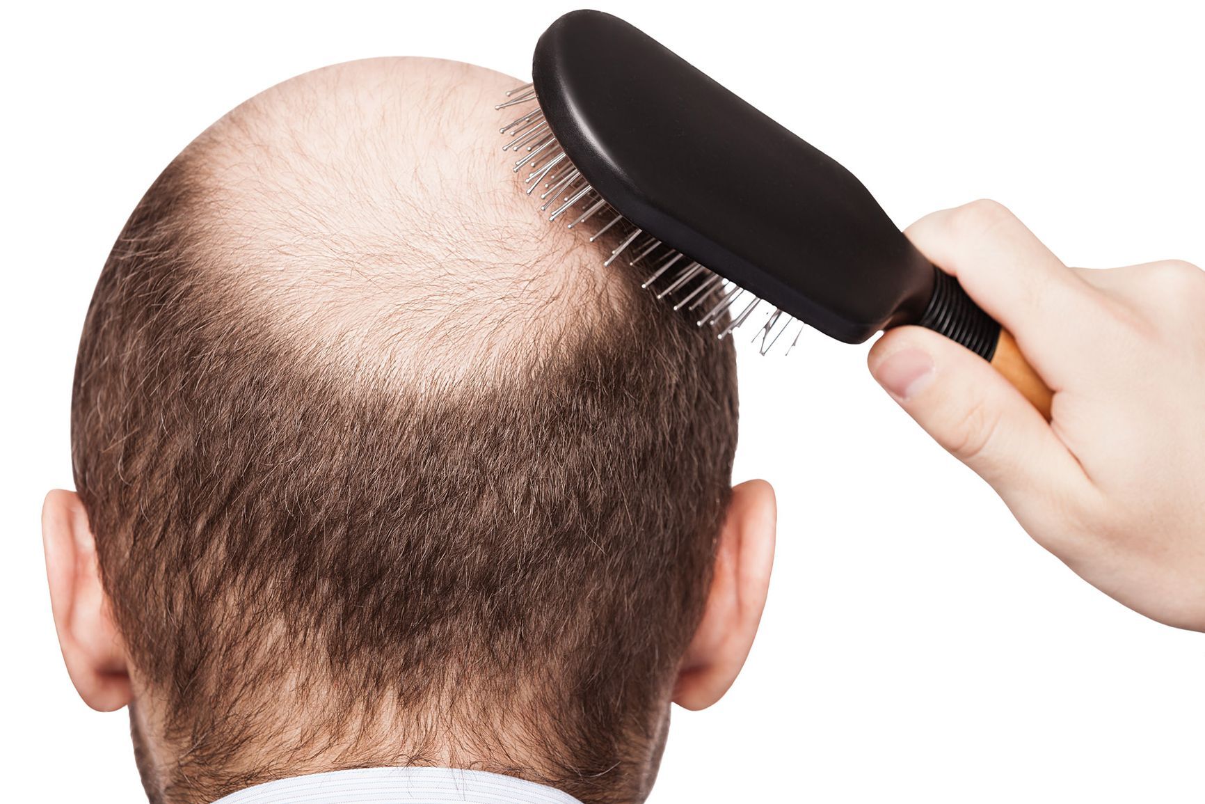 Rimozione dei capelli modi facciali Come rimuovere i peli del viso in modo efficace | ridelo.eu