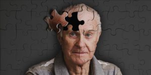 I 10 segni e sintomi dell’Alzheimer, meglio conoscerli