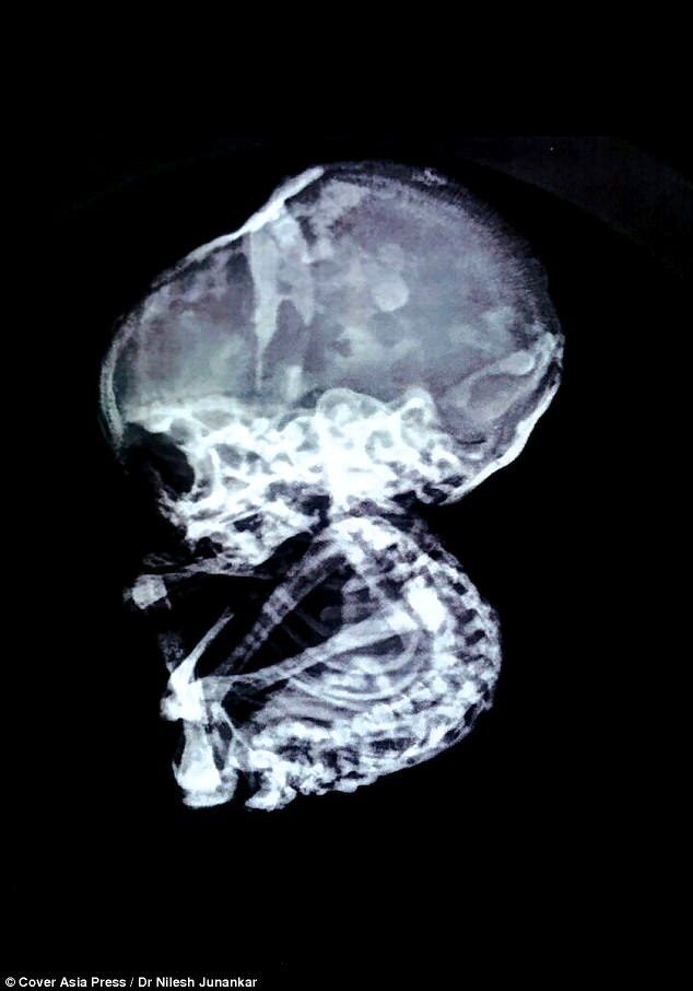 46D6A51A00000578-5132685-image-a-16_1512048953083