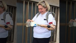 Donna con mano bionica con il senso del tatto: test riuscito