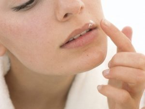 Herpes simplex orale: come si diffonde il virus e quando andare dal medico