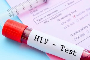 In Italia vivono 6mila persone che hanno l’HIV ma non lo sanno