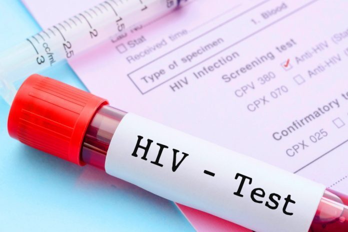 HIV