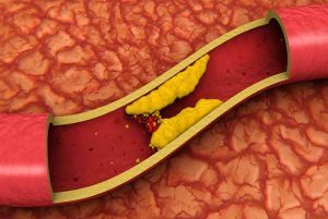 Qual è la differenza tra colesterolo buono (HDL) e cattivo (LDL)?