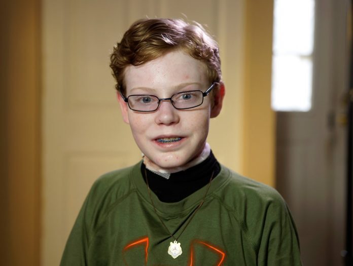 Butterfly Boy: Teens delicate skin falls offButterfly Boy: Teens delicate skin falls off