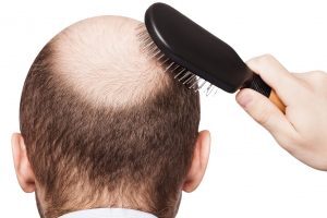 7 modi per evitare la caduta dei capelli