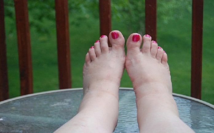 piedi-gonfi-5