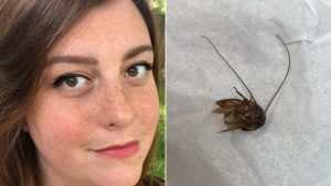 Ha uno scarafaggio nell’orecchio. L’incubo di una donna