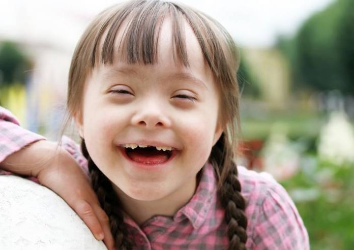 sindrome-di-down