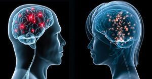 6 differenze tra il morbo di Parkinson e l’Alzheimer