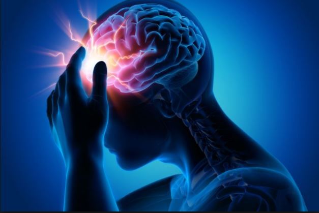epilessia epilessia