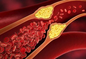 9 alimenti che aiutano a ‘sbloccare’ le arterie