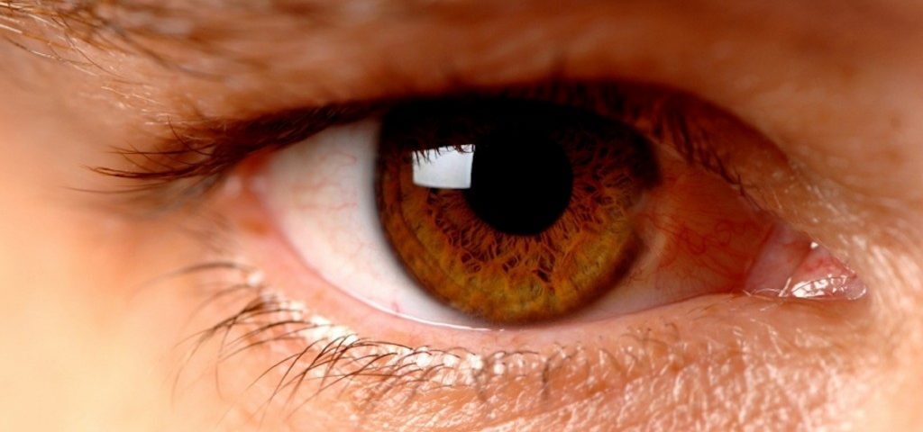 retinopatia