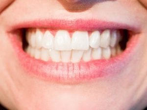 7 rimedi naturali per eliminare la placca dentale