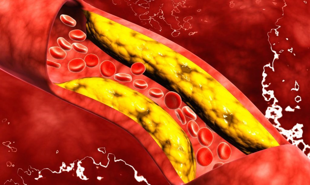 Quali sono i 5 alimenti che contrastano il colesterolo alto?