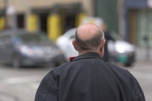 Perdi troppi capelli? C’è una buona notizia per te