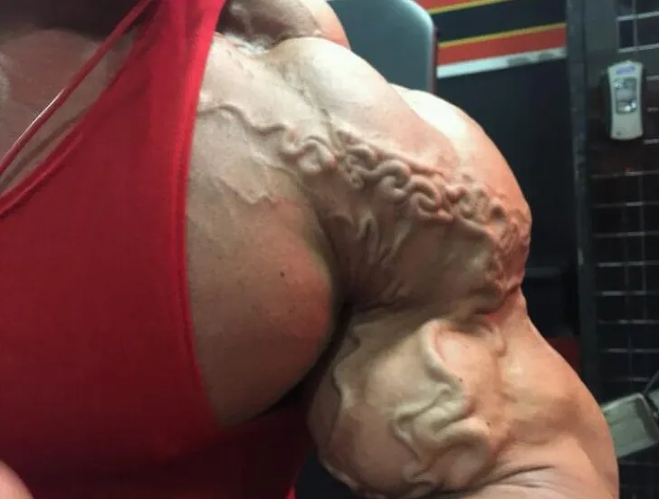 perchè si vedono le vene sulle gambe