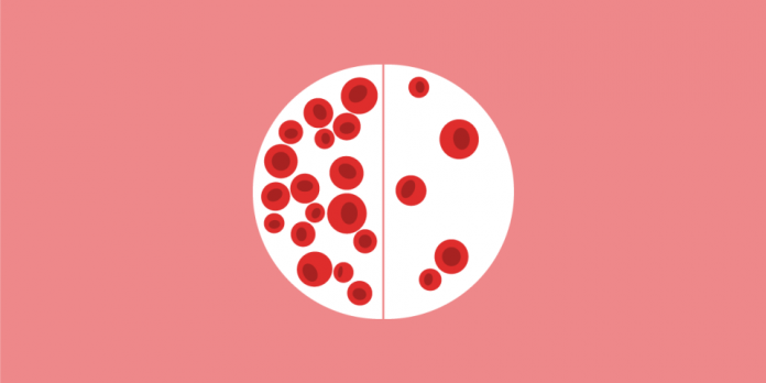 anemia anemia