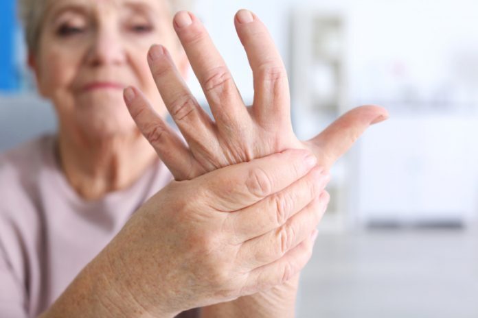 I 5 primi segni di artrite reumatoide che non vanno trascurati