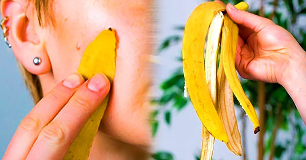 8 benefici della buccia di banana. Perché gettarla tra i rifiuti?