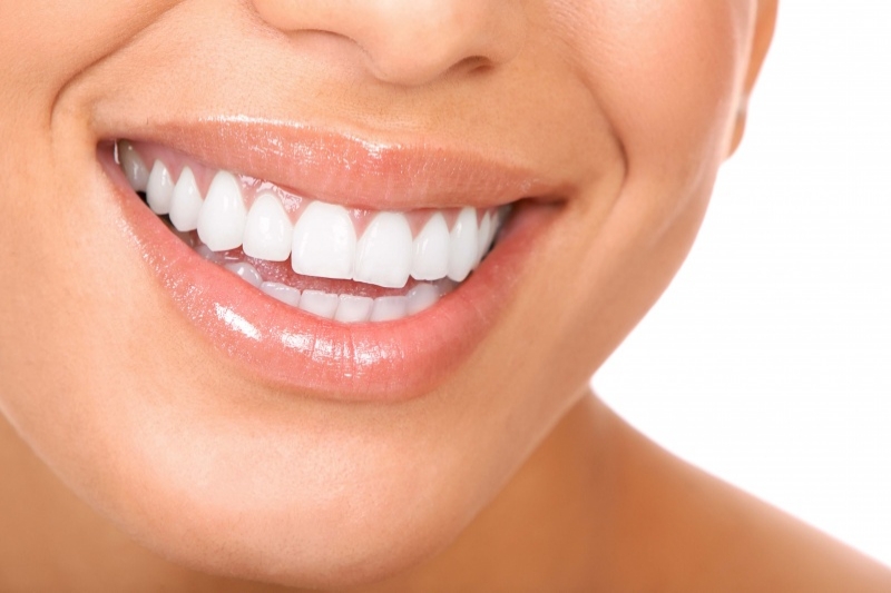 Cosa fare per mantenere in salute i tuoi denti? I 7 consigli