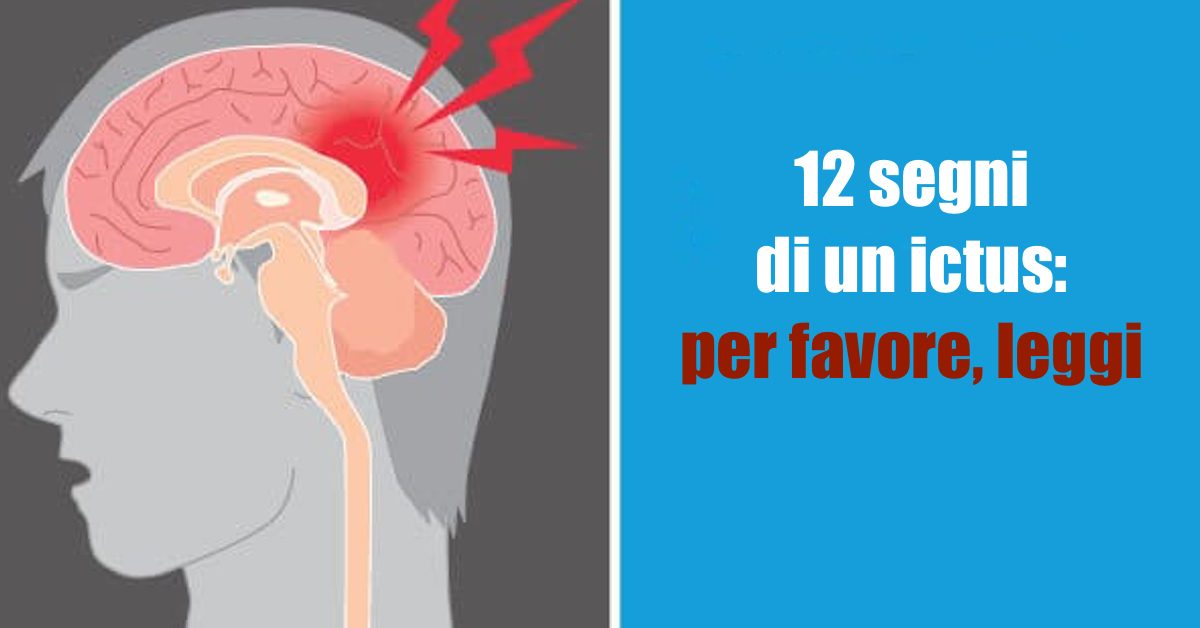Quest Ce Qui Provoque Un Ictus Amnesique Attenzione a questi 12 segni che preannunciano l'arrivo di un ictus