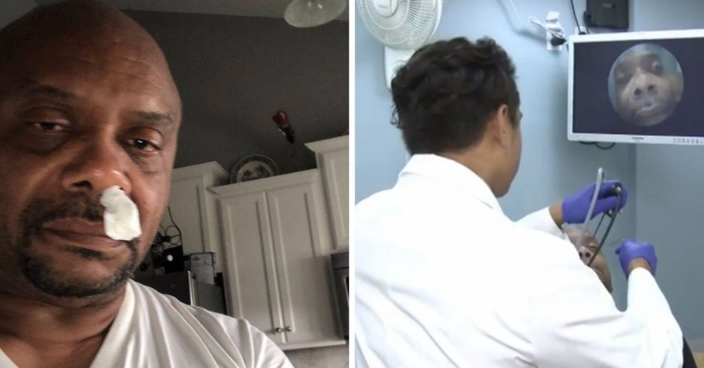 A Gregory Phillpotts il naso colava da anni. Per molti medici era per via di un'allergia. Poi, però, la diagnosi scioccante.