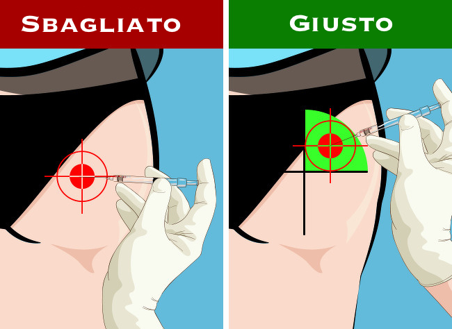 Gluteo Immagini Di Come Fare Una Puntura