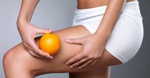 5 consigli per contrastare la cellulite