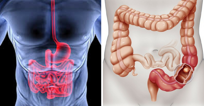 colon colon