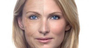 4 espressioni facciali che causano la comparsa delle rughe