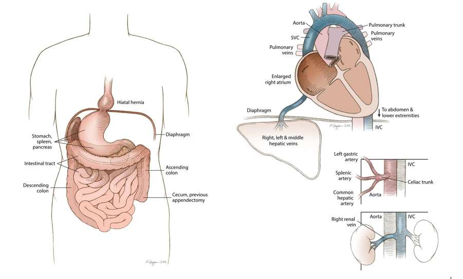 99enne ha vissuto tutta la vita con gli organi nella parte sbagliata (e non lo sapeva)