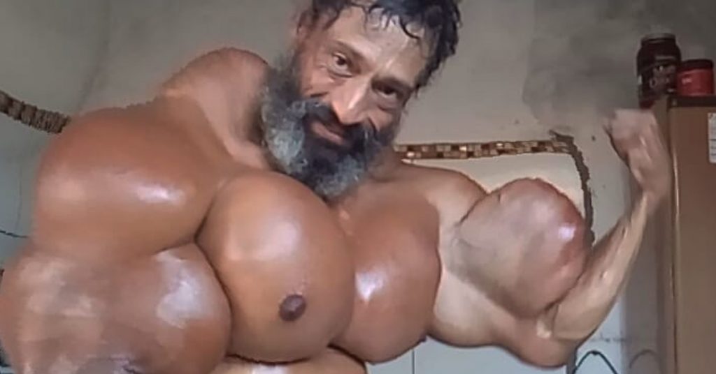 Bodybuilder rischia la sua vita per essere come l’Incredibile Hulk