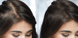 Perché le donne perdono i capelli? 7 segni spesso ignorati dell'alopecia