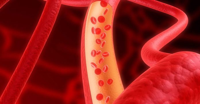 arterie