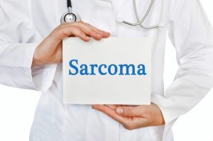 Sarcoma: cos’è, fattori di rischio e sintomi