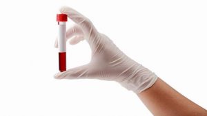 Analisi del sangue: quali sono i valori di riferimento?