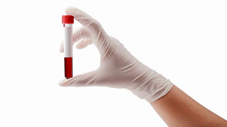 Analisi del sangue: quali sono i valori di riferimento?