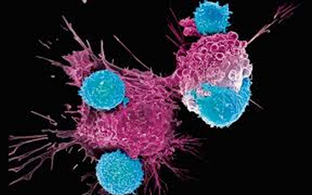Il trattamento per il cancro del sangue potrebbe uccidere anche i tumori solidi