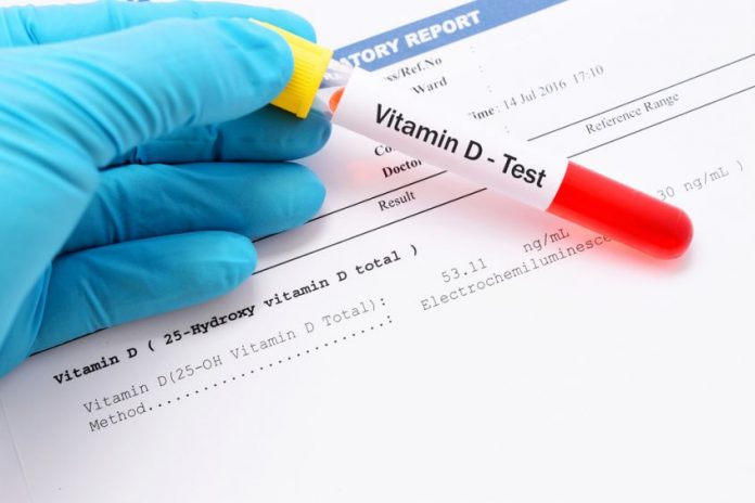 carenza vitamina d