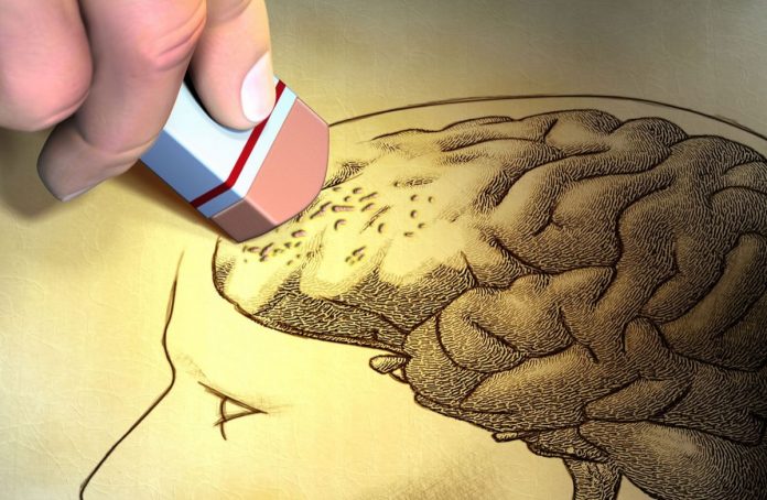 alzheimer