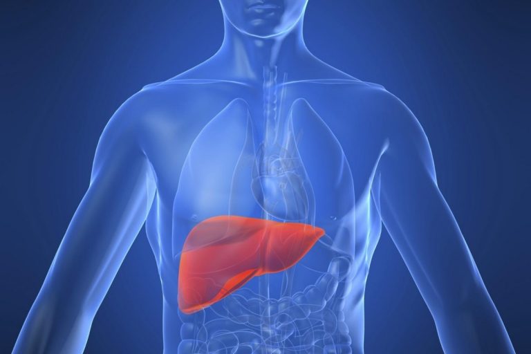 Cirrosi epatica cos'è, cause, sintomi e