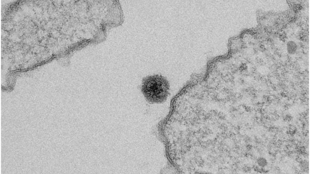 Yaravirus: cos’è e come è stato scoperto