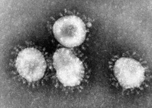 Team scientifico canadese ha isolato il nuovo Coronavirus