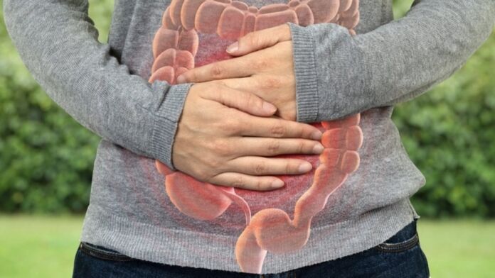 cancro colon