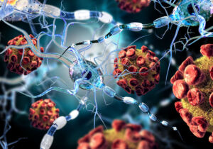 Coronavirus: quali sono i sintomi neurologici che provoca il Covid-19?