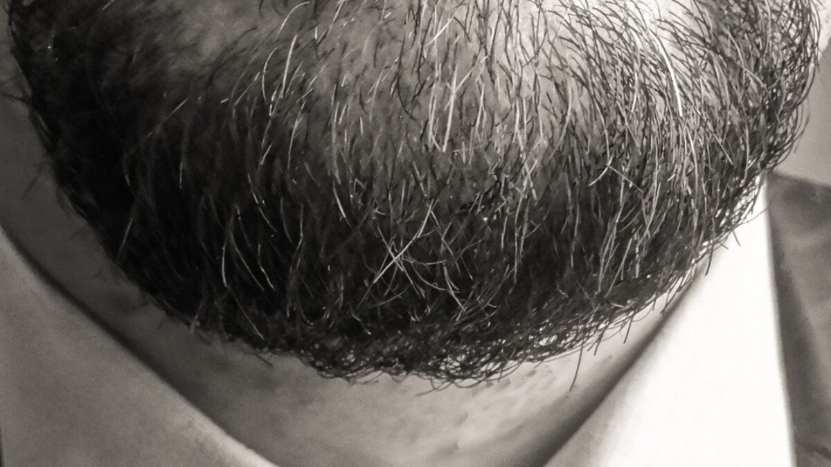 Perche Lo Stress Fa Venire La Barba Bianca