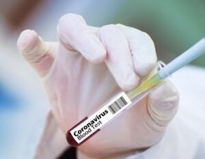 Coronavirus, Johnson & Johnson avvia fase finale di test sul vaccino