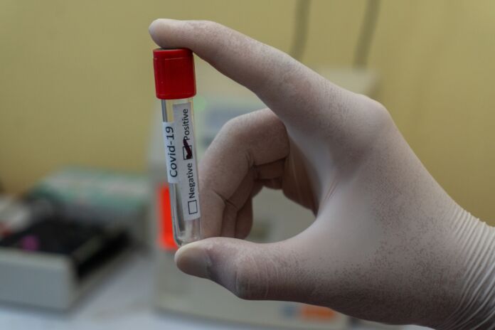coronavirus