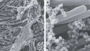 Come il Coronavirus conquista una cellula umana